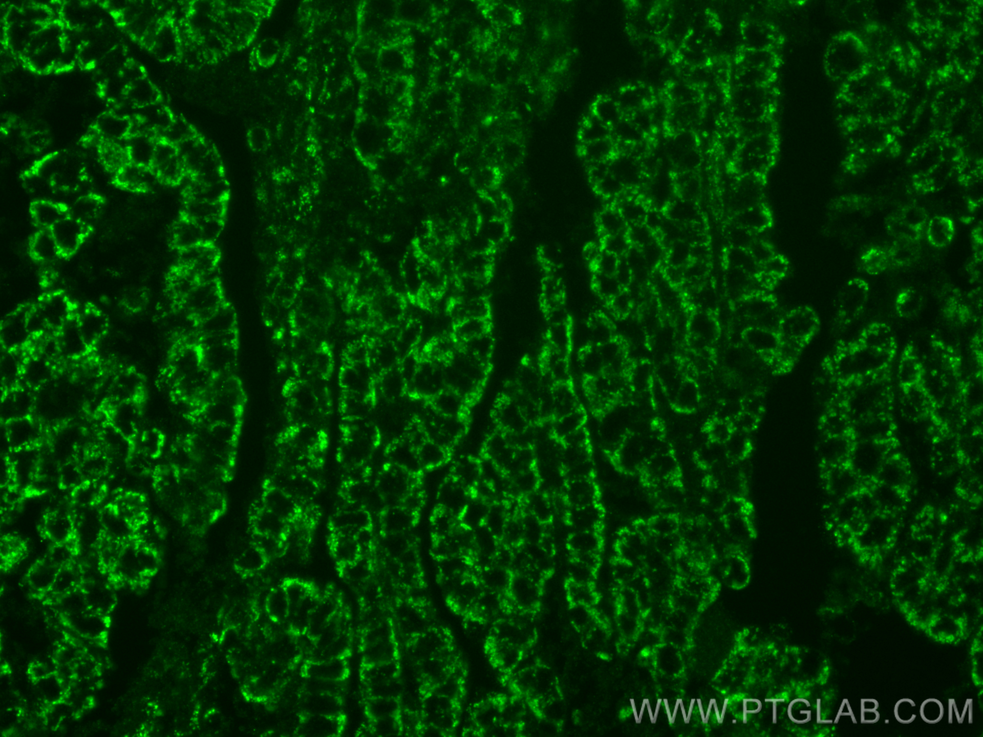 Immunofluorescence (IF) / fluorescent staining of human ovary tumor tissue using CD82 Monoclonal antibody (66803-1-Ig)