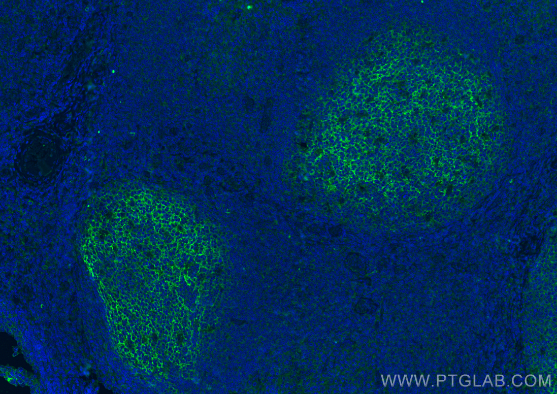 Immunofluorescence (IF) / fluorescent staining of human tonsillitis tissue using CD82 Monoclonal antibody (66803-1-Ig)