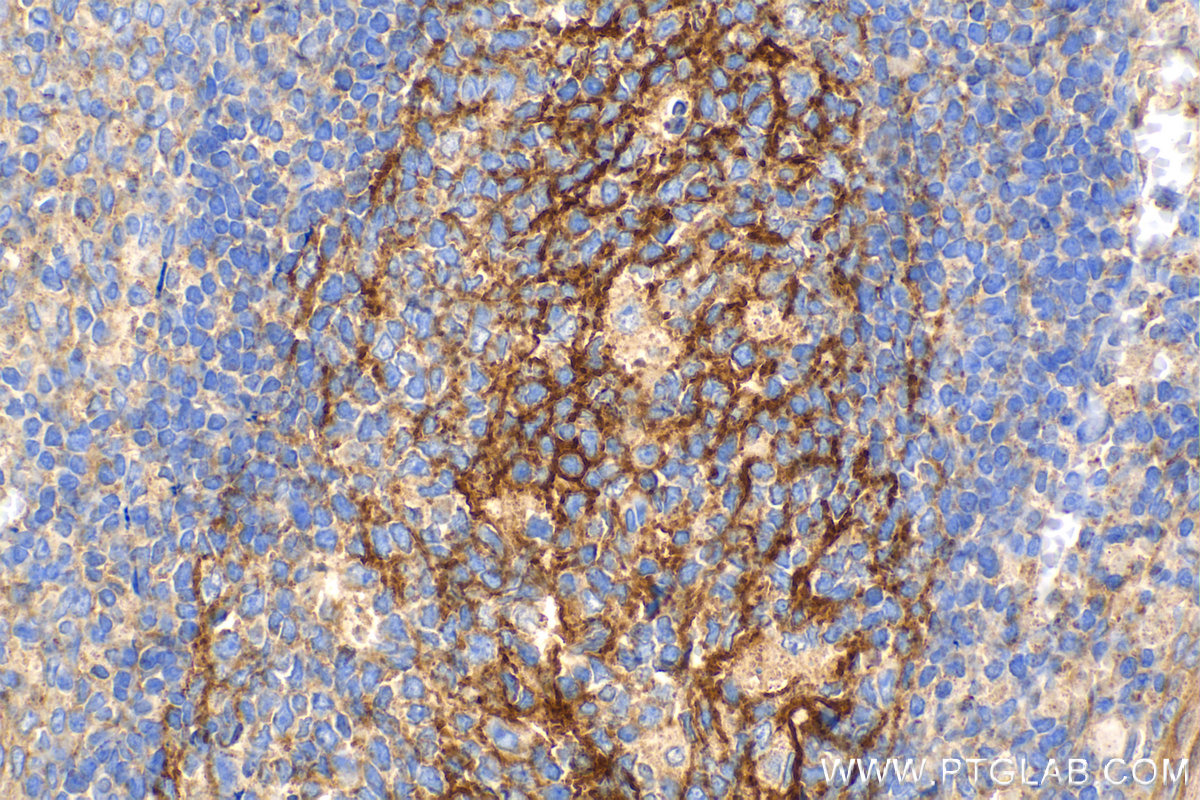 Immunohistochemistry (IHC) staining of human tonsillitis tissue using CD82 Monoclonal antibody (66803-1-Ig)