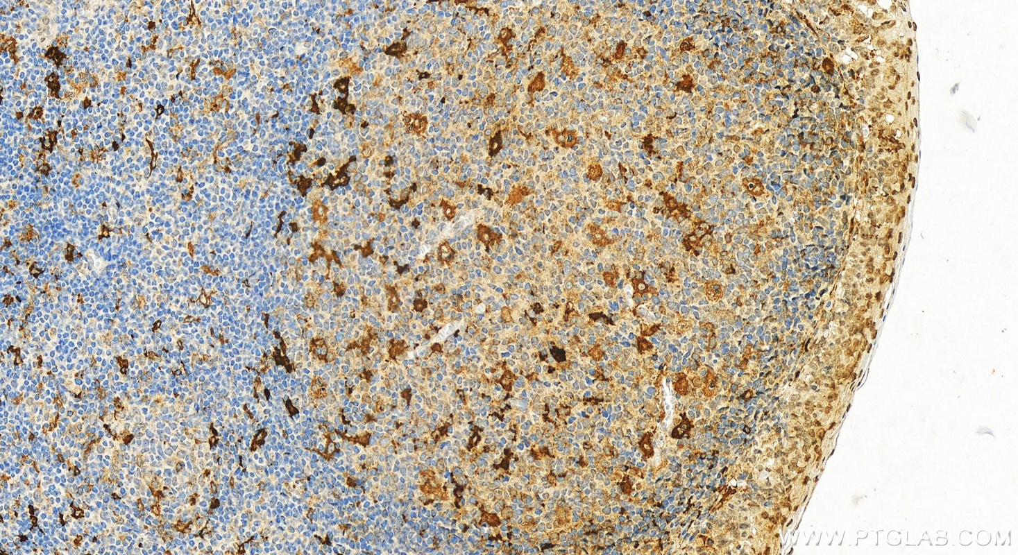 Immunohistochemistry (IHC) staining of human tonsillitis tissue using CD83 Polyclonal antibody (32149-1-AP)