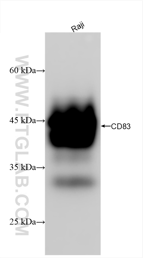 Western Blot (WB) analysis of various lysates using CD83 Recombinant antibody (84796-3-RR)