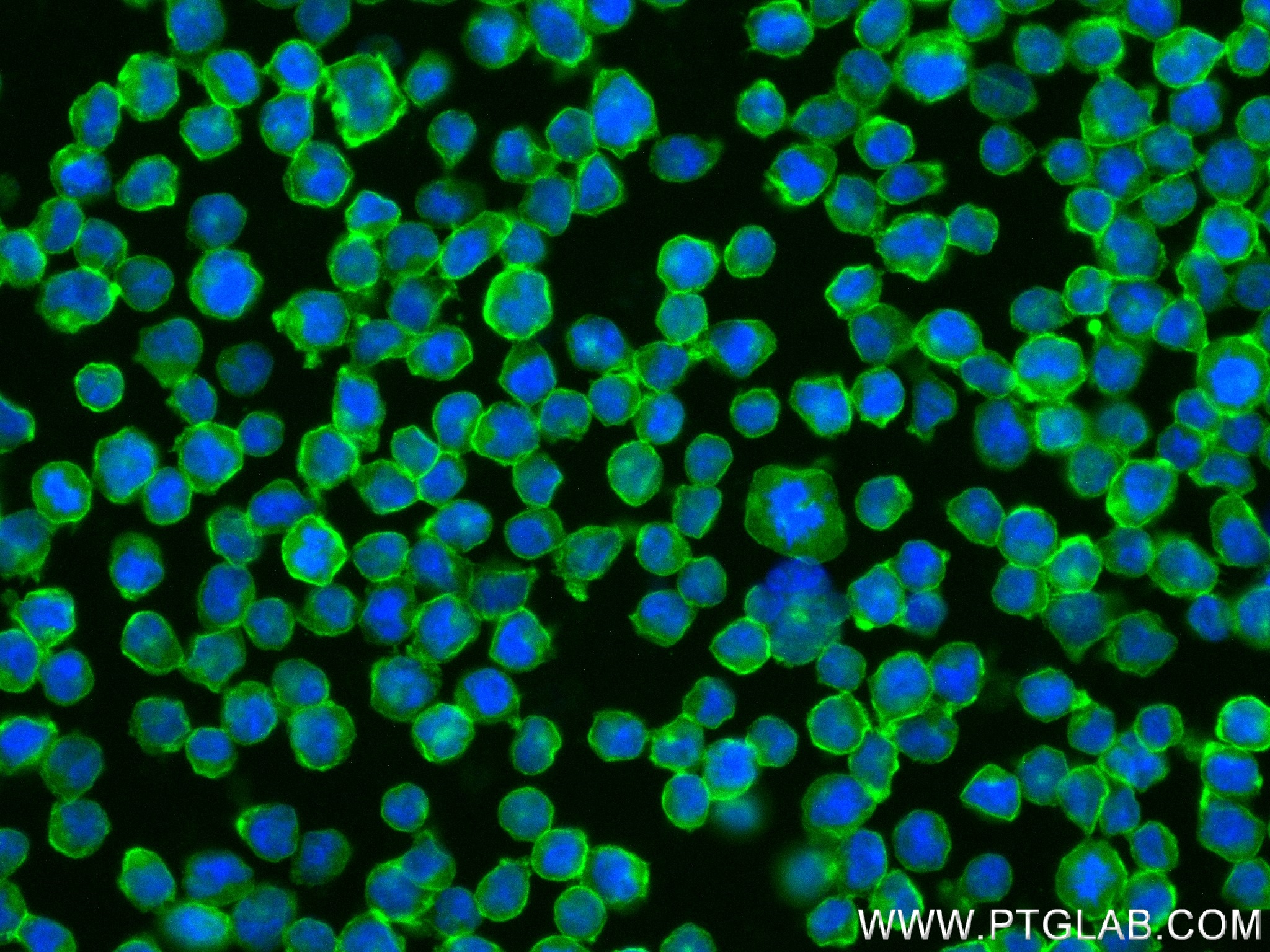 Immunofluorescence (IF) / fluorescent staining of Raji cells using CD84 Recombinant antibody (84245-2-RR)