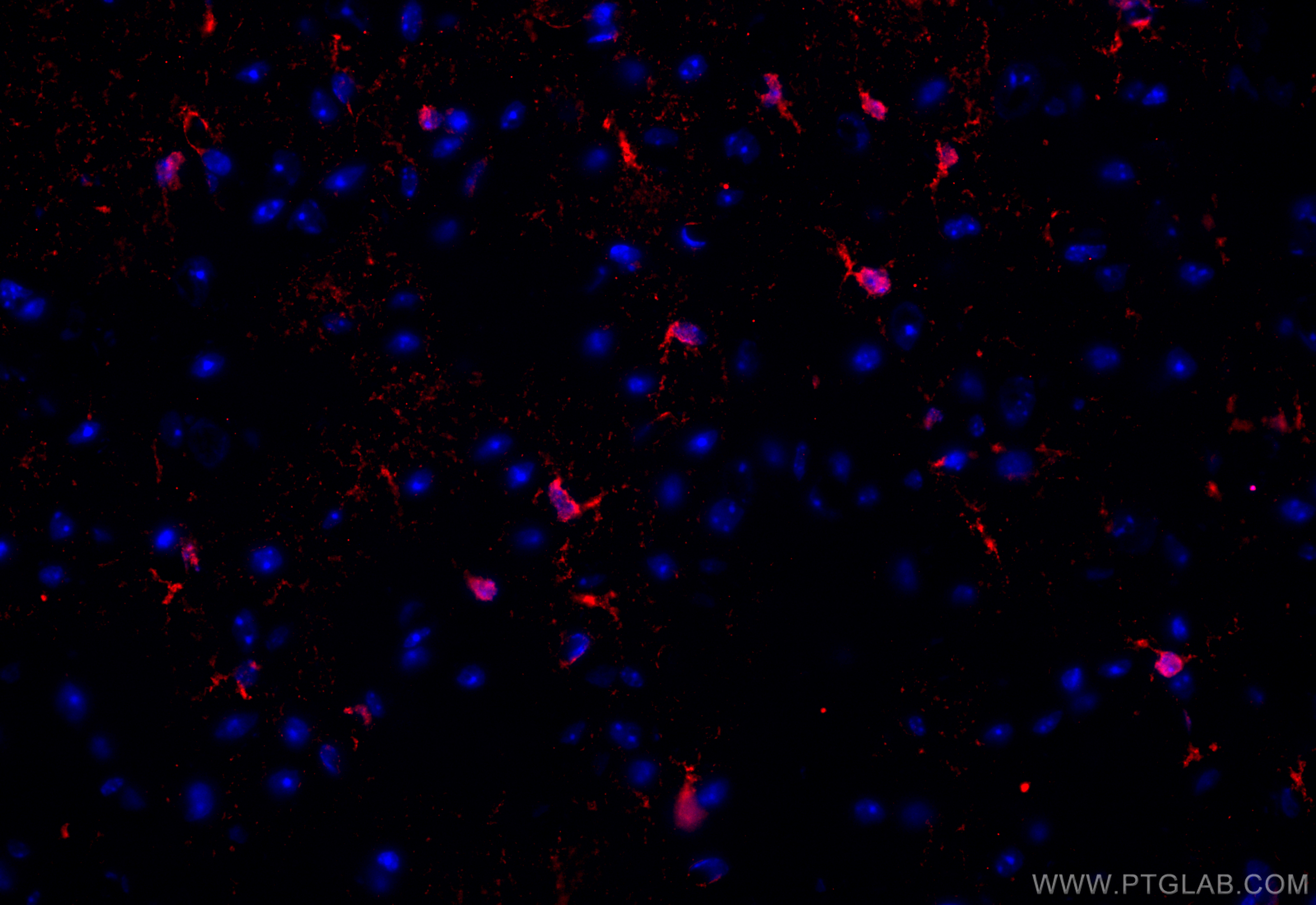 Immunofluorescence (IF) / fluorescent staining of mouse brain tissue using CD86 (C-terminal) Polyclonal antibody (26903-1-AP)