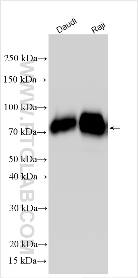 Western Blot (WB) analysis of Daudi cells using CD86 Polyclonal antibody (31449-1-AP)