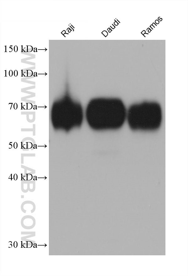 Western Blot (WB) analysis of various lysates using CD86 Monoclonal antibody (68674-2-Ig)