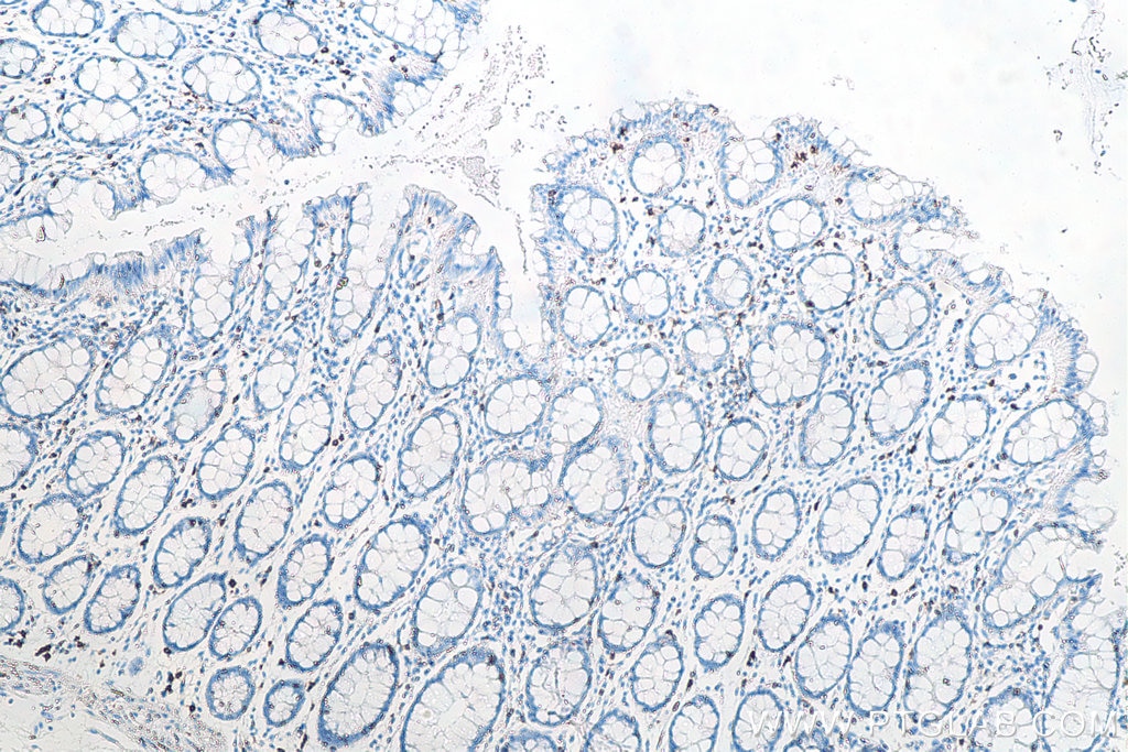 Immunohistochemistry (IHC) staining of human colon tissue using CD8a Monoclonal antibody (66868-1-Ig)