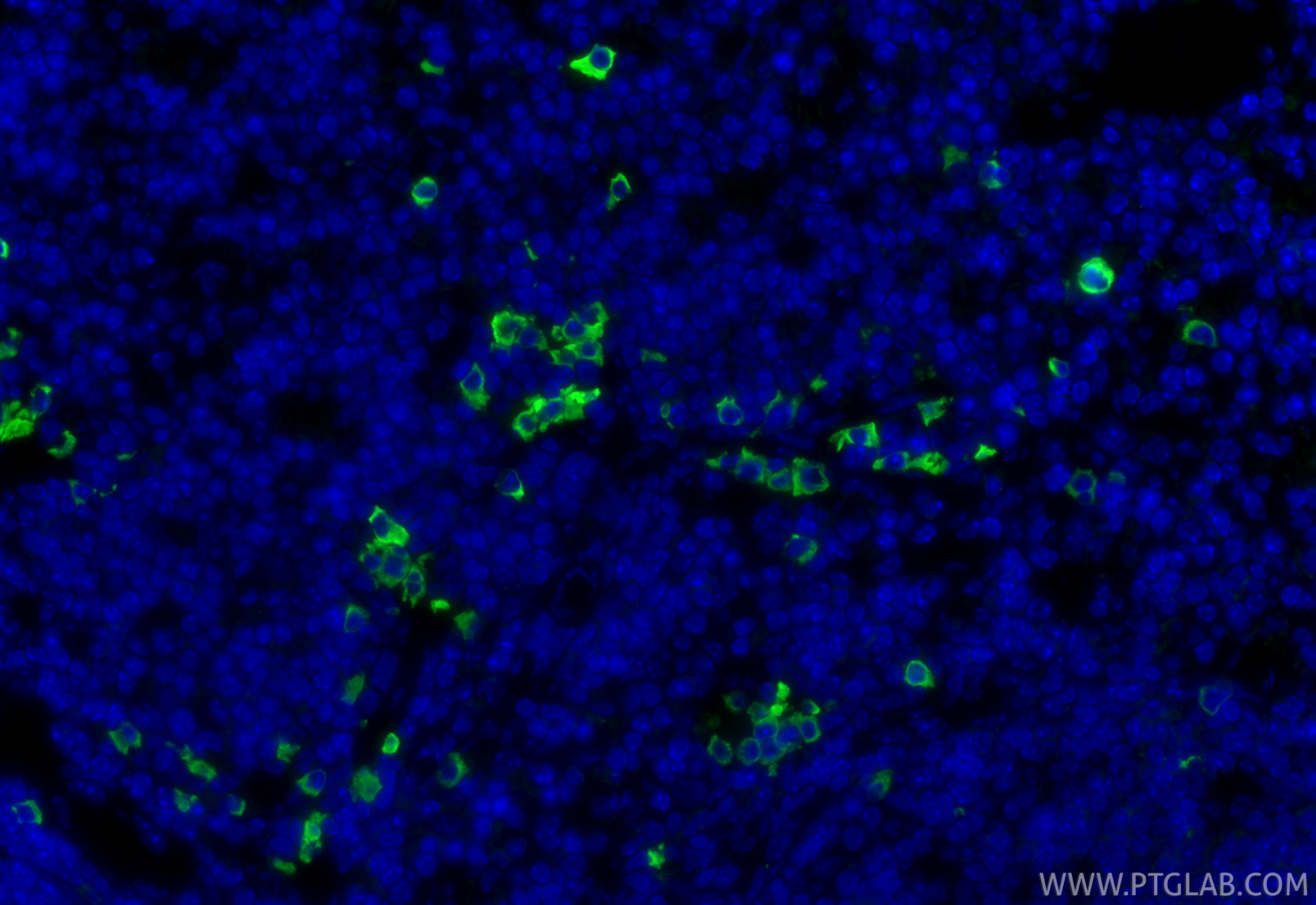 Immunofluorescence (IF) / fluorescent staining of mouse spleen tissue using Anti-Mouse CD8a (53-6.7) (65069-1-Ig)