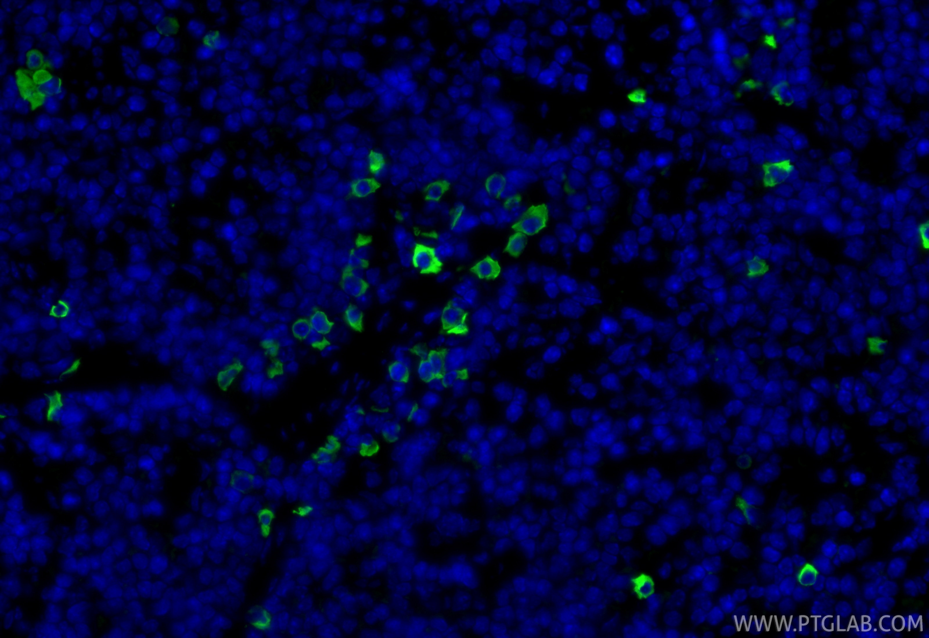 Immunofluorescence (IF) / fluorescent staining of mouse spleen tissue using Anti-Mouse CD8a (5H10-1) (65205-1-Ig)