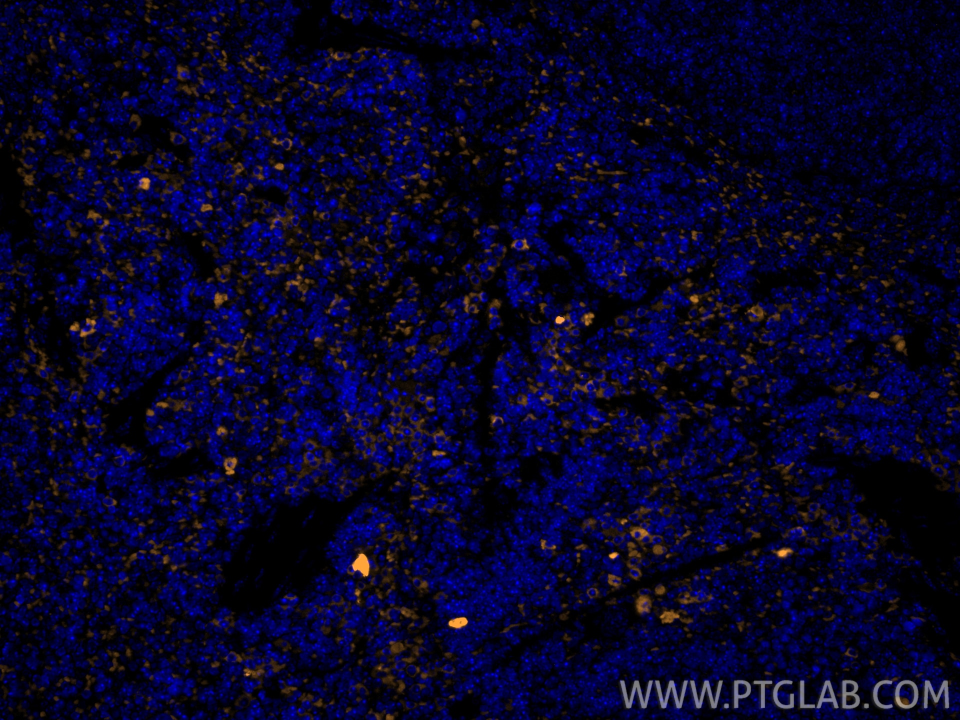 Immunofluorescence (IF) / fluorescent staining of mouse spleen tissue using Anti-Mouse CD8a (5H10-1) (65205-1-Ig)