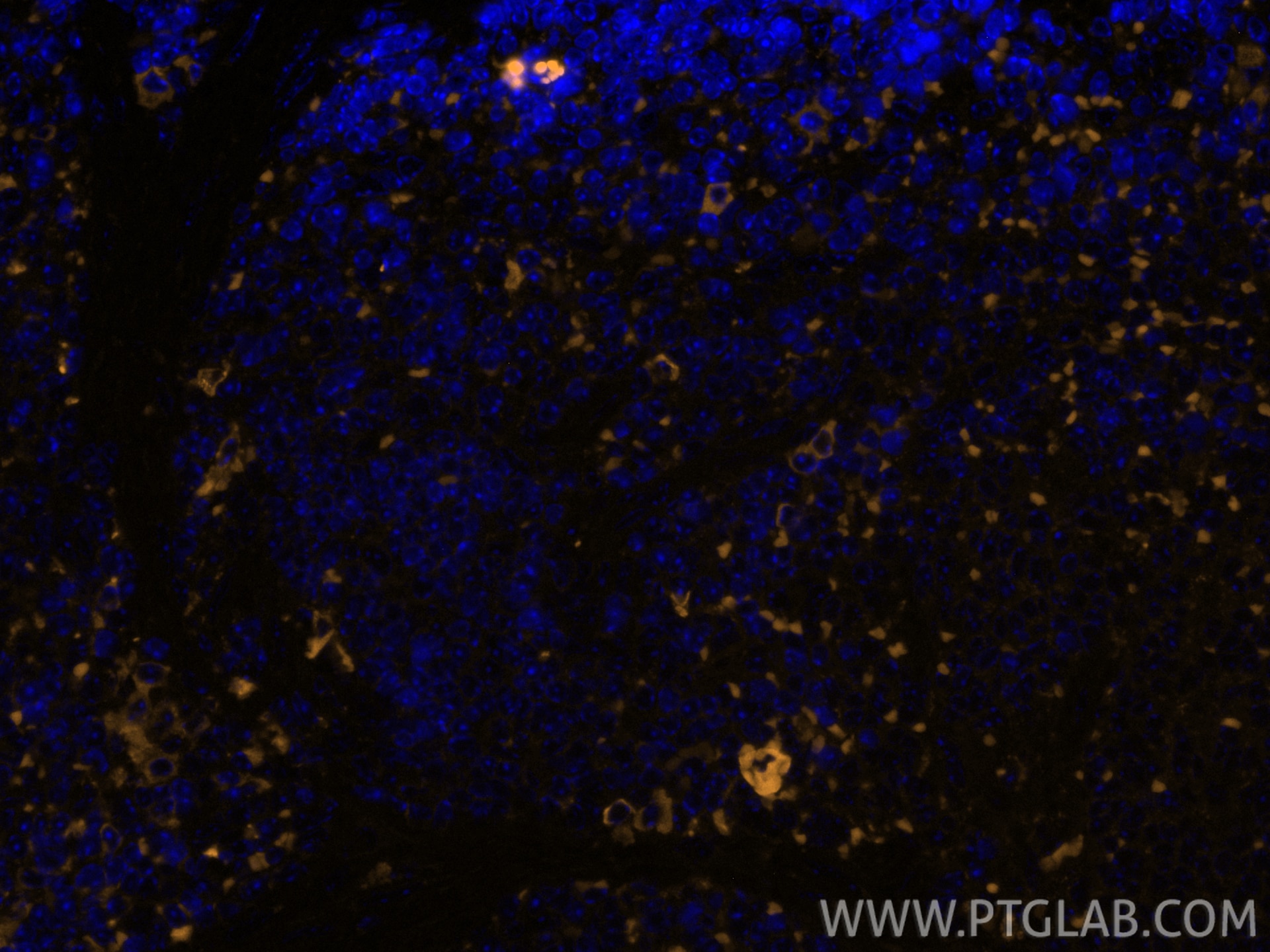 Immunofluorescence (IF) / fluorescent staining of mouse spleen tissue using Anti-Mouse CD8a (5H10-1) (65205-1-Ig)