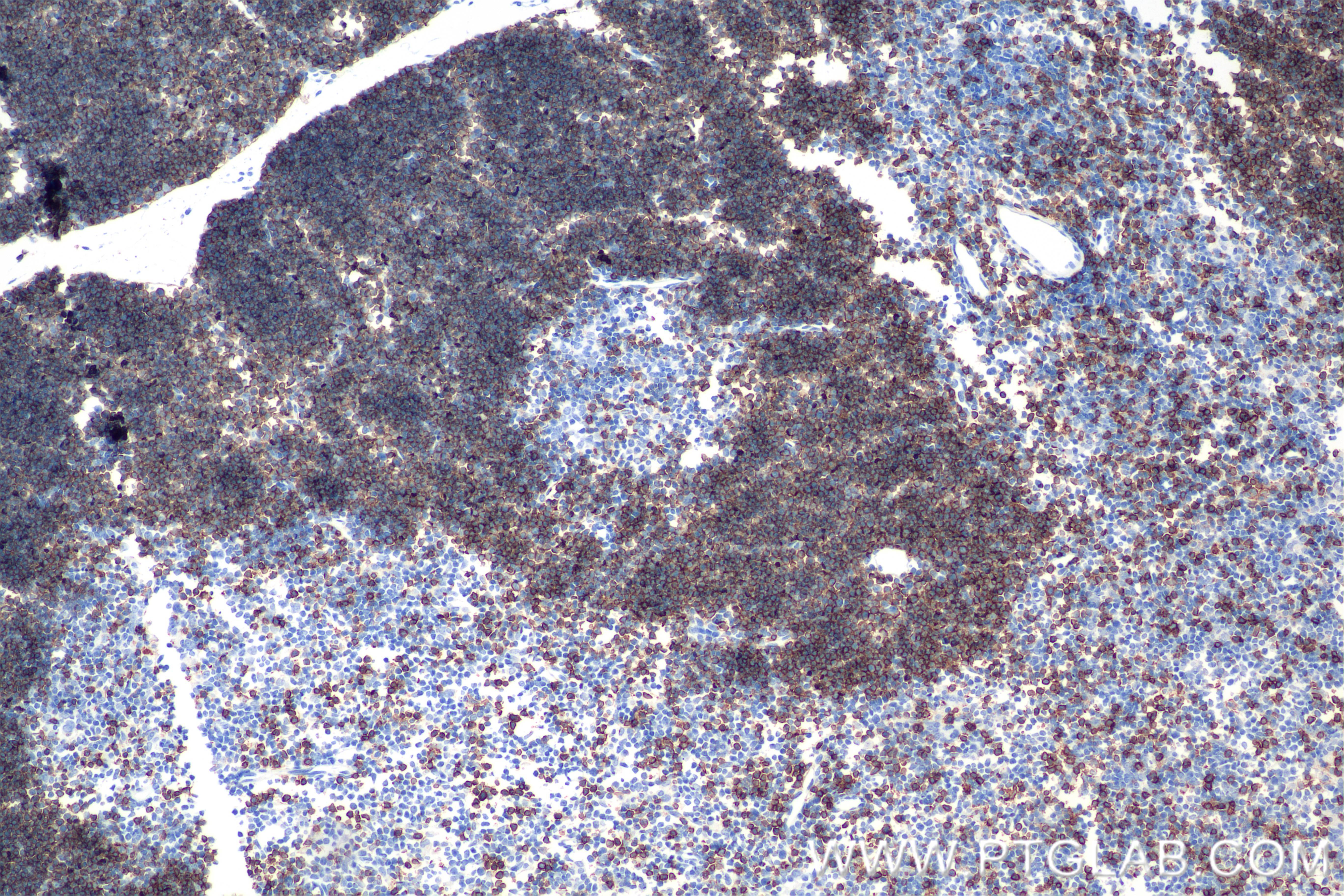 Immunohistochemistry (IHC) staining of mouse thymus tissue using CD8a Recombinant antibody (85977-4-RR)