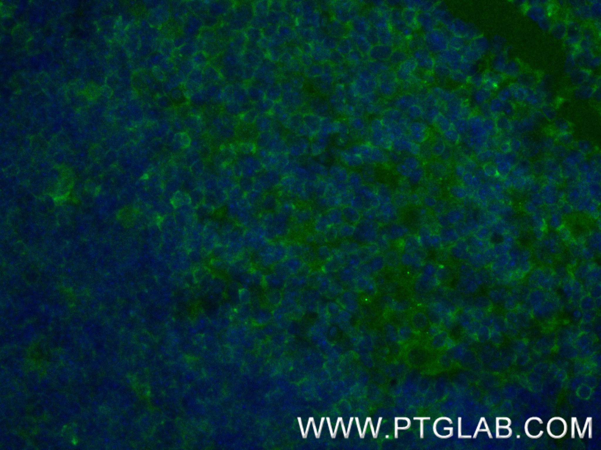 Immunofluorescence (IF) / fluorescent staining of mouse thymus tissue using CD8a Recombinant antibody (86063-1-RR)