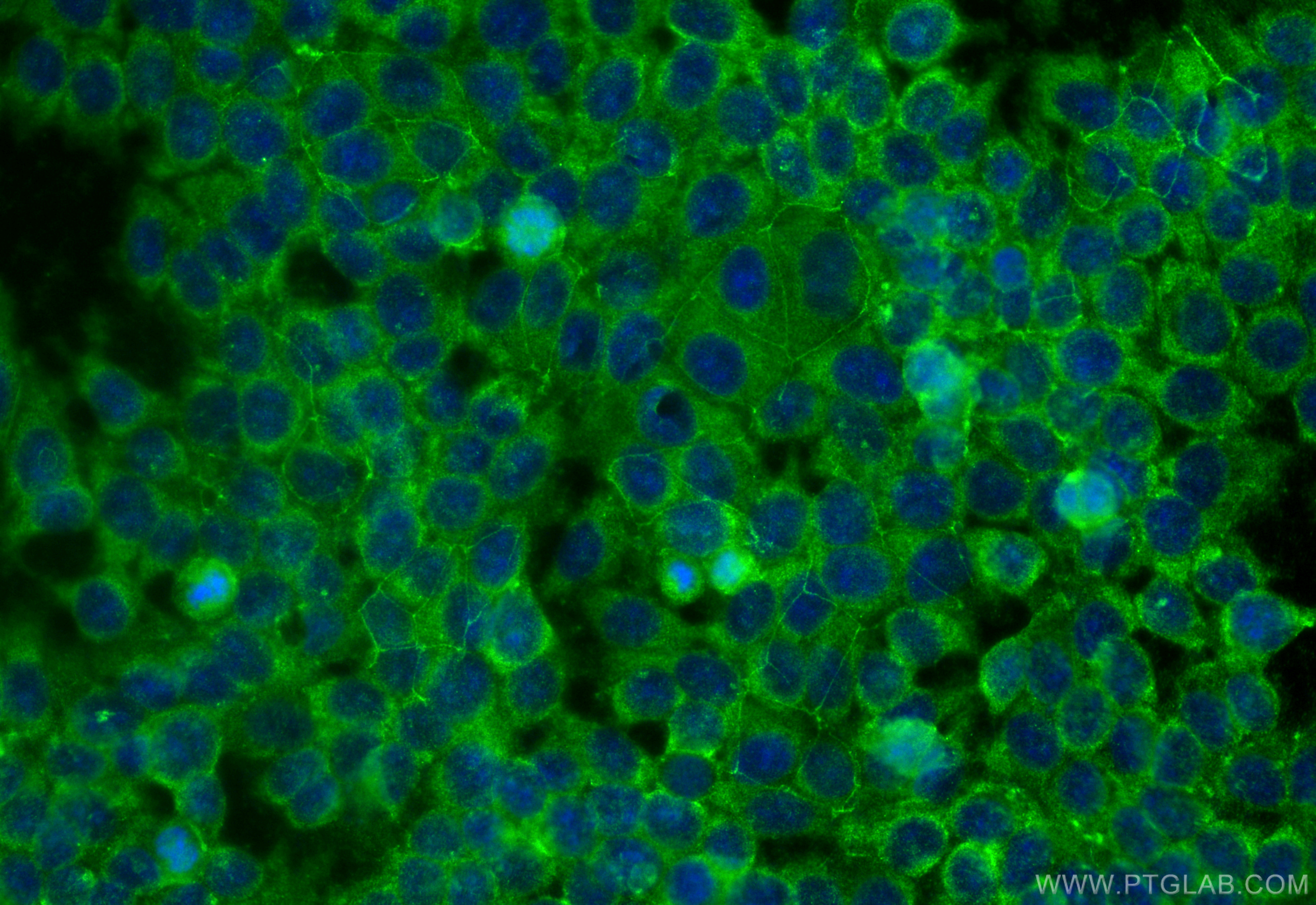 Immunofluorescence (IF) / fluorescent staining of MCF-7 cells using CD9 Monoclonal antibody (60232-1-Ig)