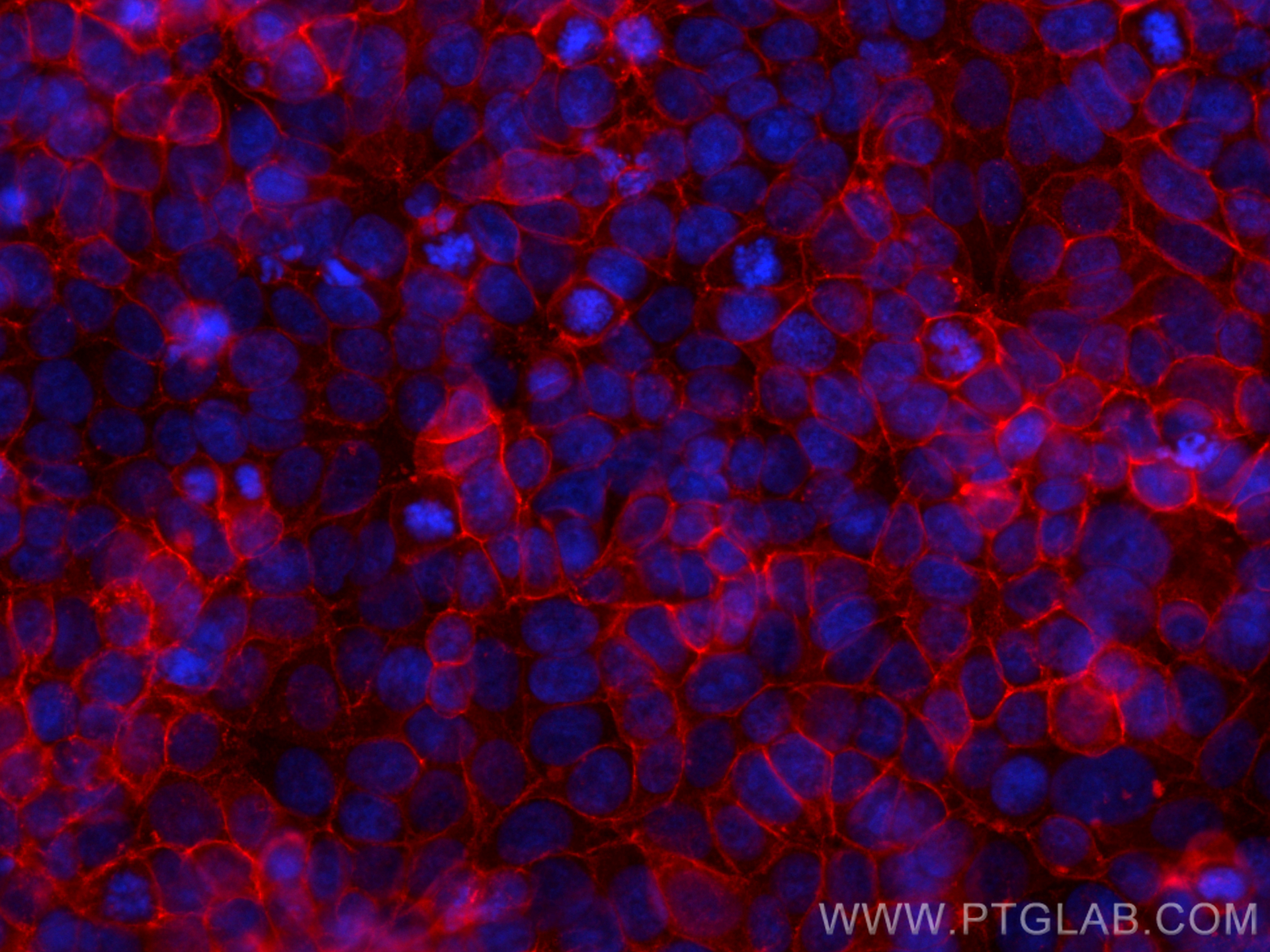 Immunofluorescence (IF) / fluorescent staining of MCF-7 cells using CD9 Recombinant antibody (82105-1-RR)