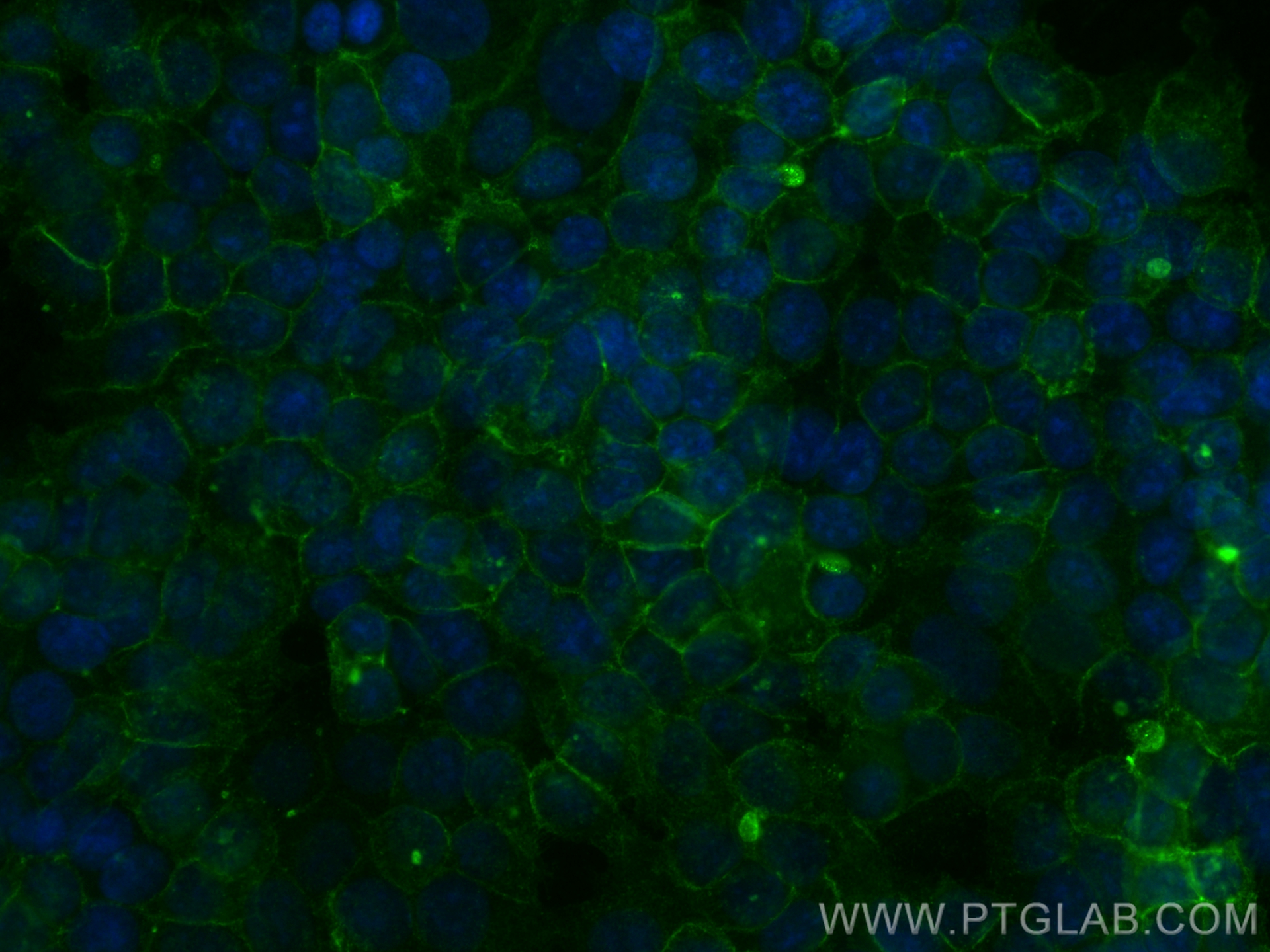 Immunofluorescence (IF) / fluorescent staining of MCF-7 cells using CD9 Recombinant antibody (84142-1-RR)