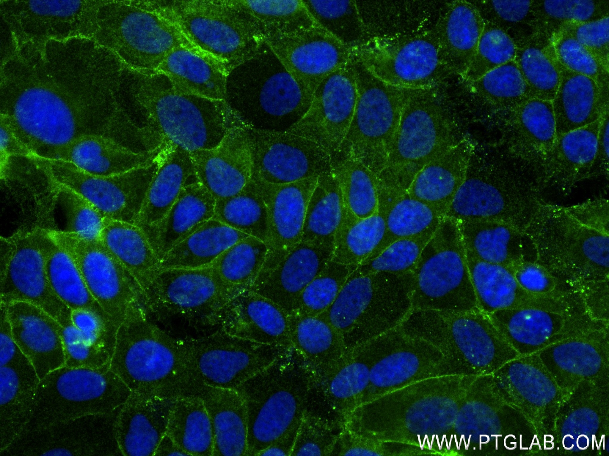 Immunofluorescence (IF) / fluorescent staining of MCF-7 cells using CD9 Recombinant antibody (84142-2-RR)