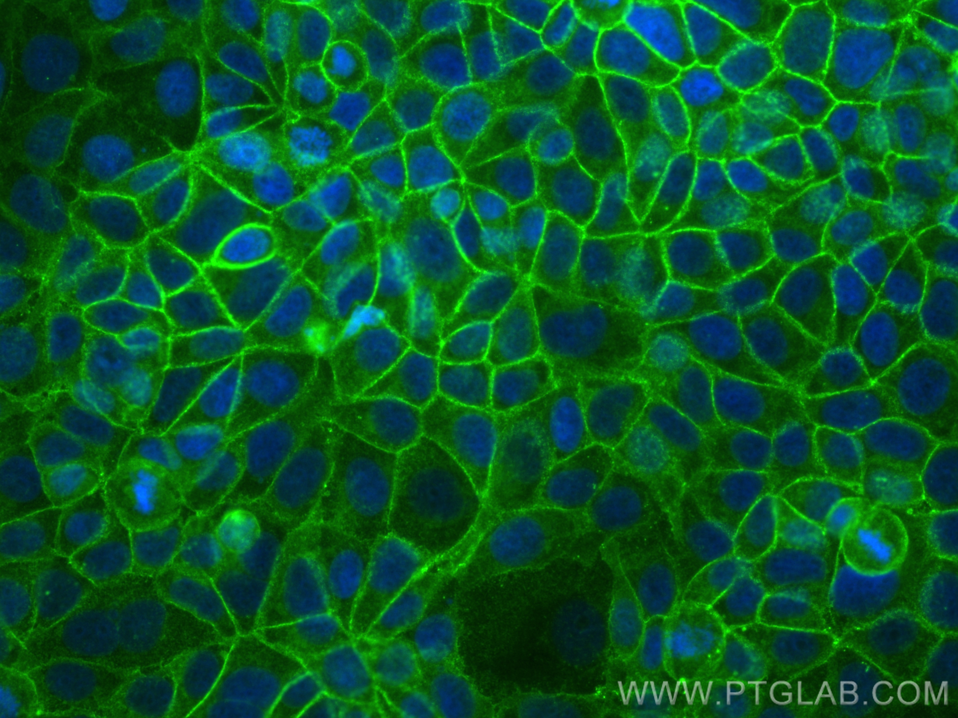 Immunofluorescence (IF) / fluorescent staining of MCF-7 cells using CD9 Recombinant antibody (84142-2-RR)