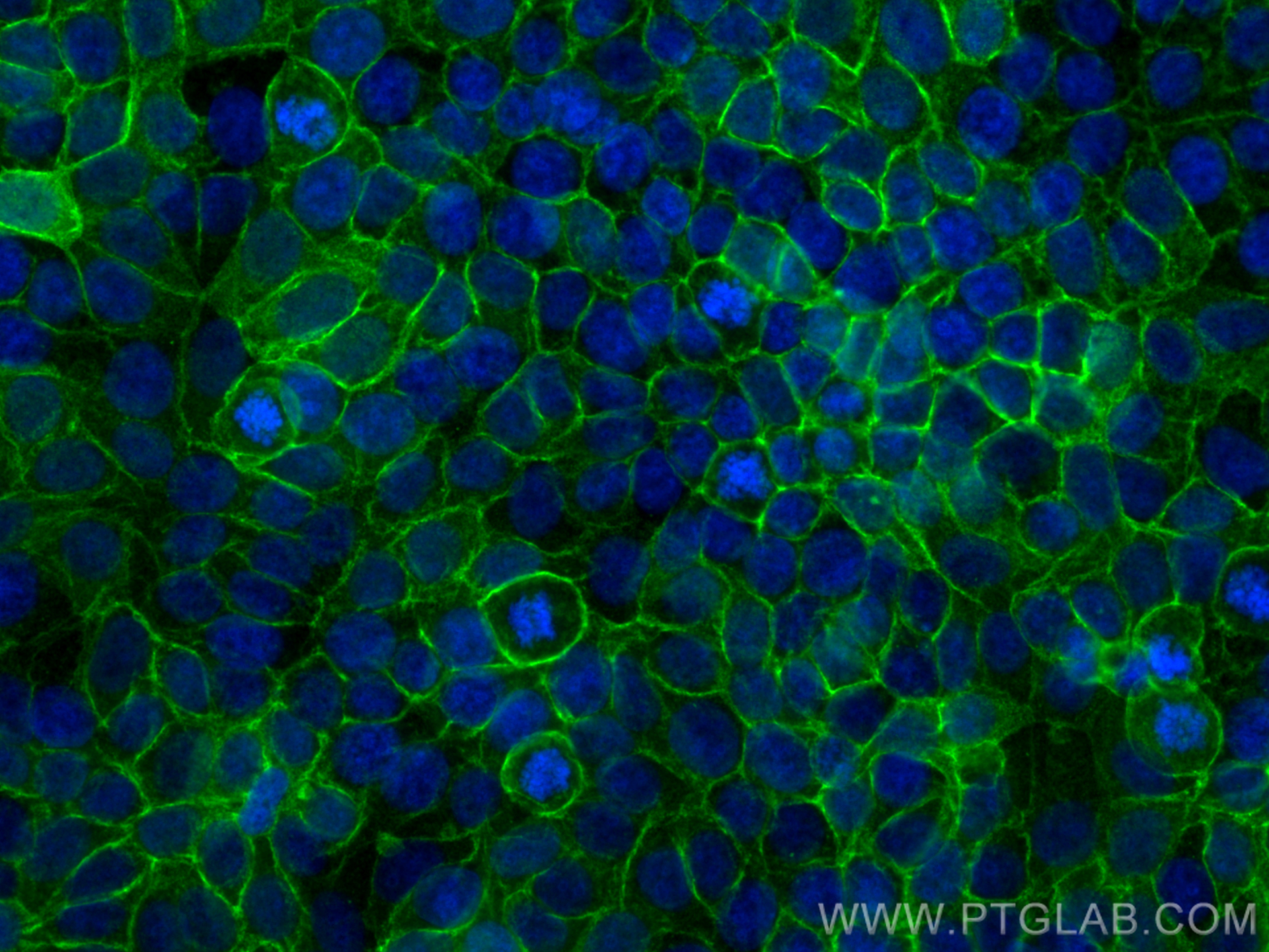 Immunofluorescence (IF) / fluorescent staining of MCF-7 cells using Multi-rAb™ CD9 Multi-Recombinant antibody (RMX00018)