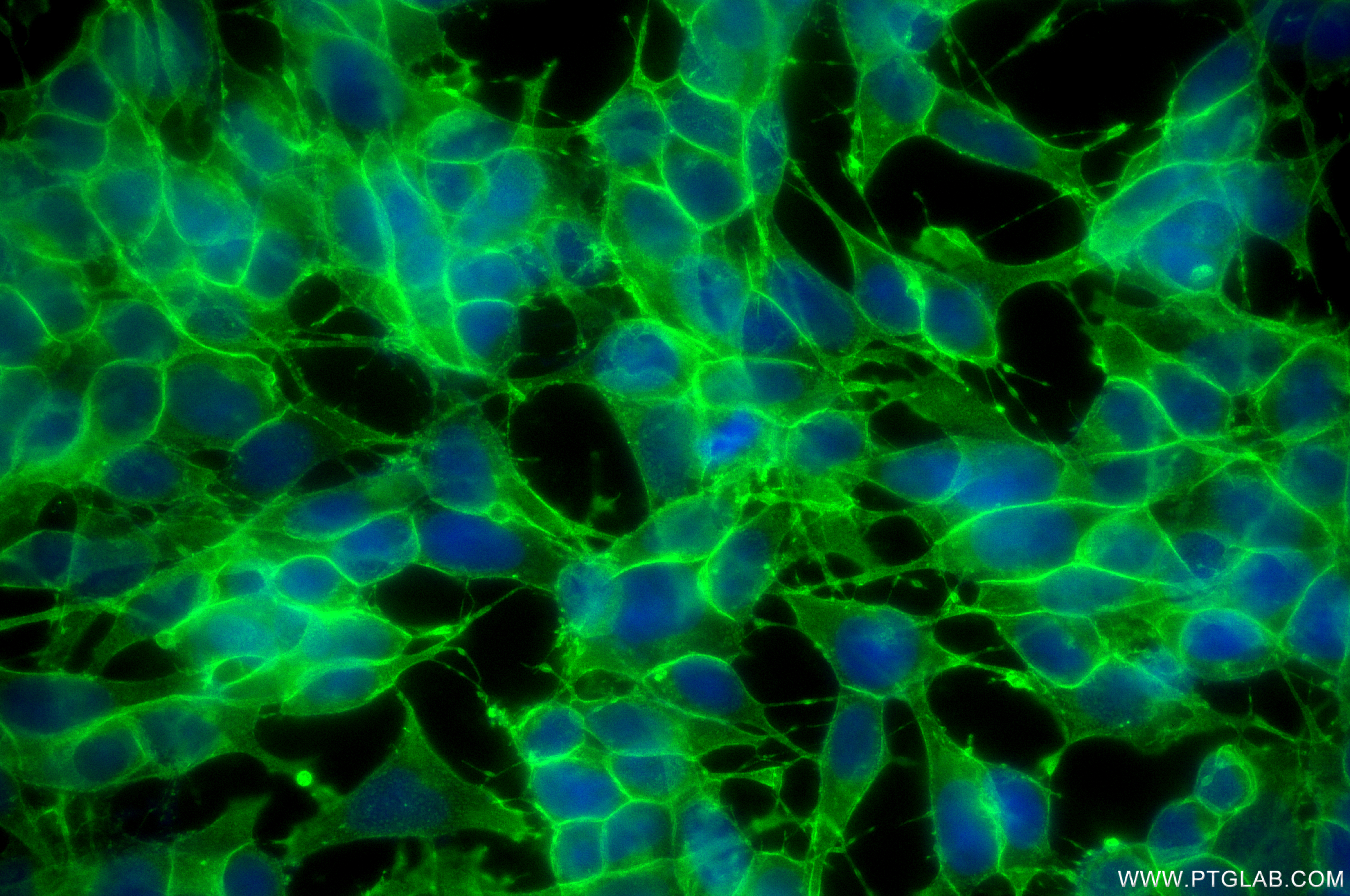 Immunofluorescence (IF) / fluorescent staining of SH-SY5Y cells using CD90 Recombinant antibody (84180-1-RR)