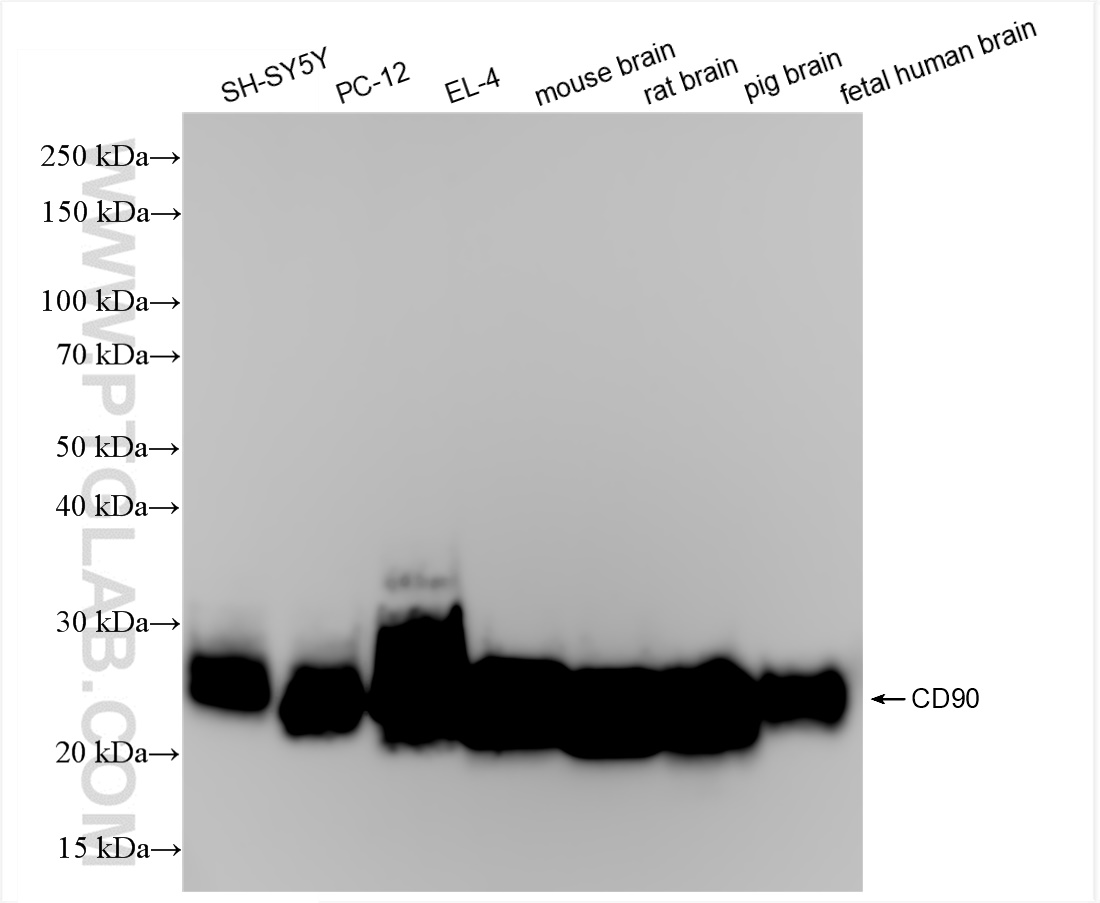 Western Blot (WB) analysis of various lysates using CD90 Recombinant antibody (84180-1-RR)