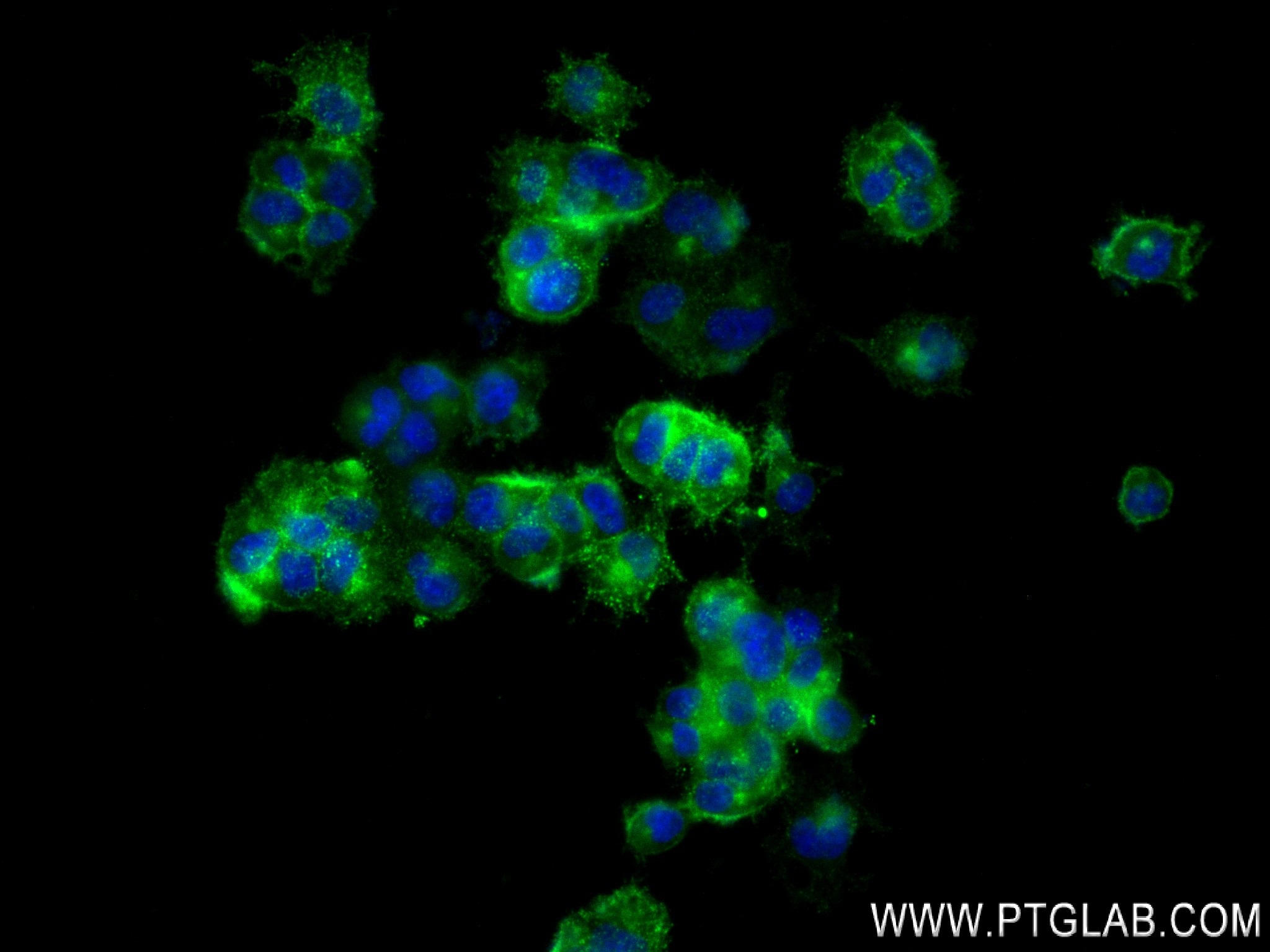 Immunofluorescence (IF) / fluorescent staining of PC-12 cells using CD90/Thy1 Recombinant antibody (84206-3-RR)