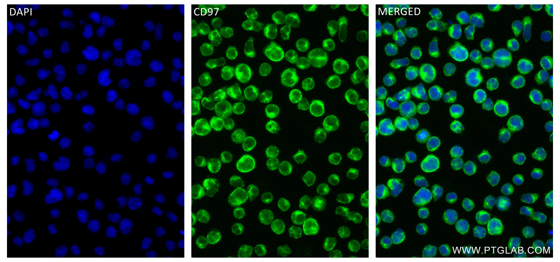 Immunofluorescence (IF) / fluorescent staining of Jurkat cells using CD97 Recombinant antibody (84255-6-RR)