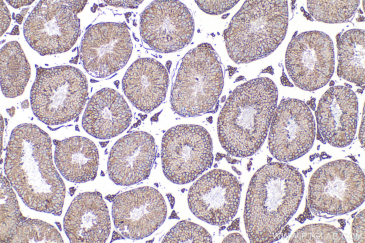 Immunohistochemistry (IHC) staining of mouse testis tissue using CD98/SLC3A2 Polyclonal antibody (32010-1-AP)