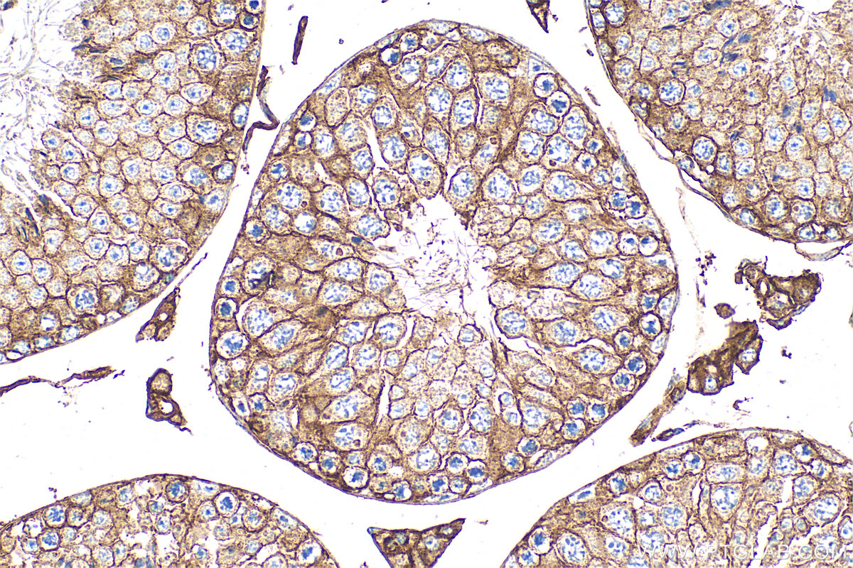 Immunohistochemistry (IHC) staining of mouse testis tissue using CD98/SLC3A2 Polyclonal antibody (32010-1-AP)