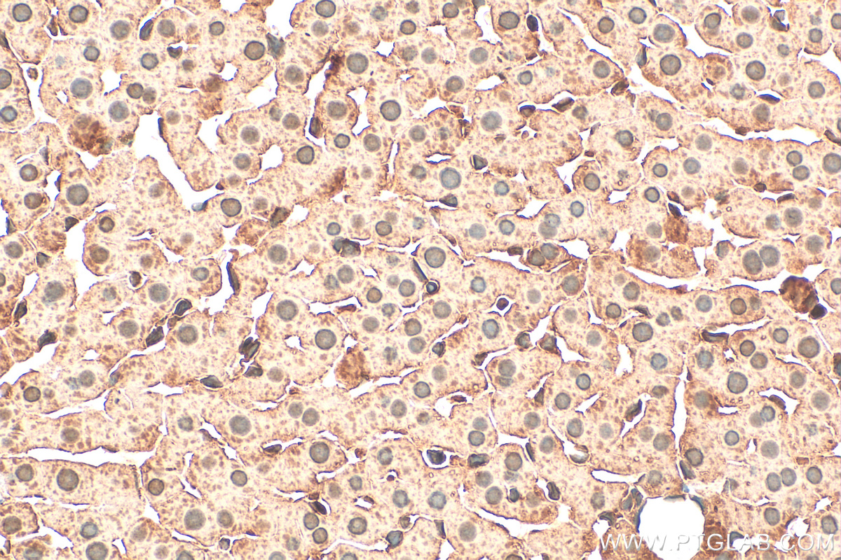 Immunohistochemistry (IHC) staining of rat liver tissue using CDK1-Specific Polyclonal antibody (19532-1-AP)