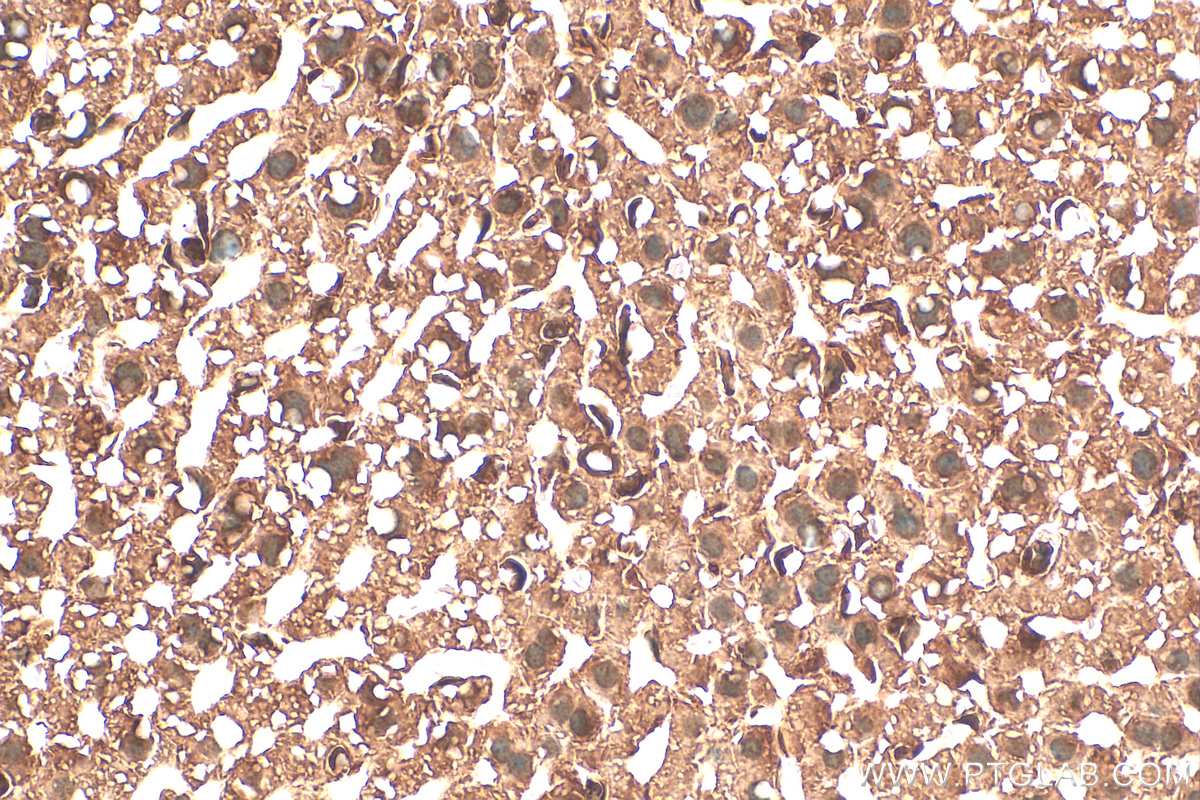 Immunohistochemistry (IHC) staining of mouse liver tissue using CDK1-Specific Polyclonal antibody (19532-1-AP)