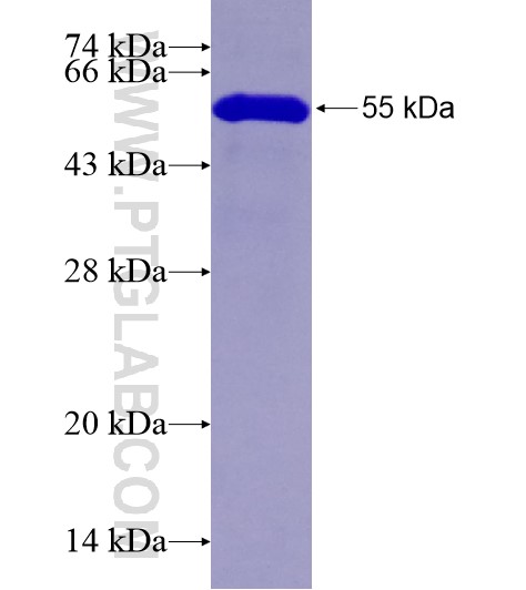 CDC2L1 fusion protein Ag28743 SDS-PAGE