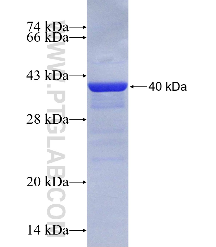 CDC2L1 fusion protein Ag28756 SDS-PAGE