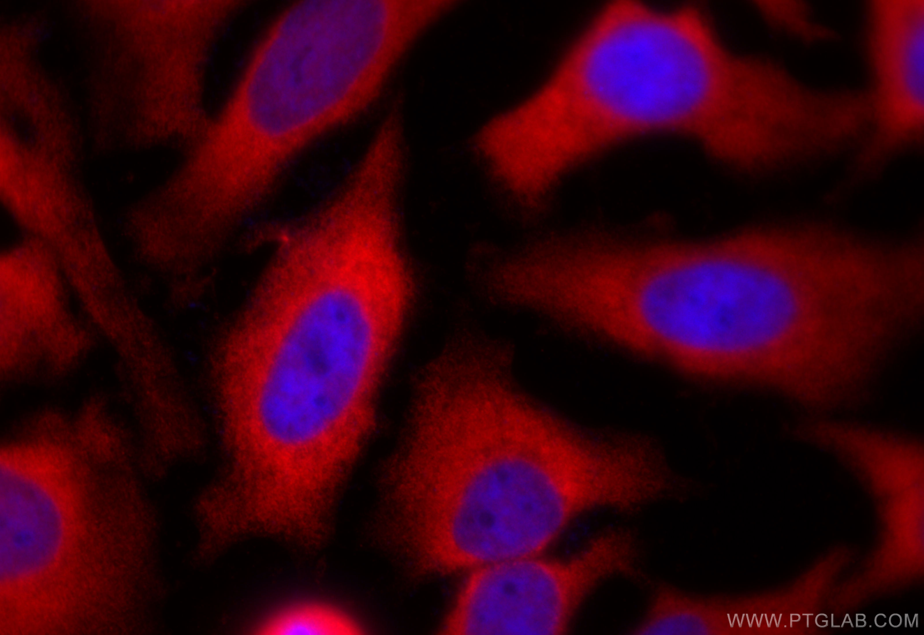 Immunofluorescence (IF) / fluorescent staining of HeLa cells using CDC37 Polyclonal antibody (10218-1-AP)