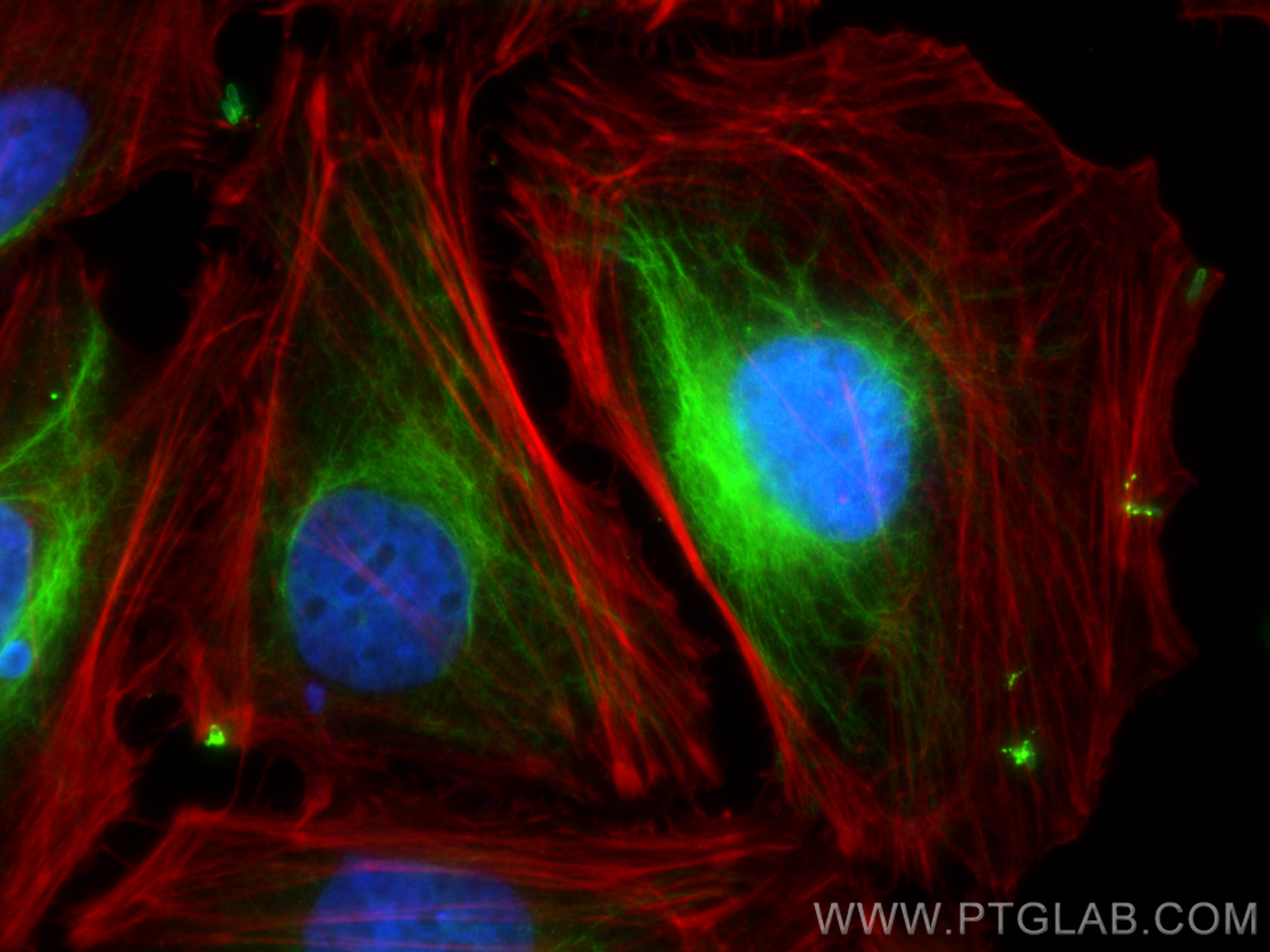 Immunofluorescence (IF) / fluorescent staining of HeLa cells using CDC42 Polyclonal antibody (10155-1-AP)