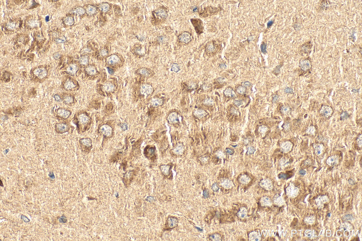 Immunohistochemistry (IHC) staining of rat brain tissue using CDC42 Polyclonal antibody (10155-1-AP)