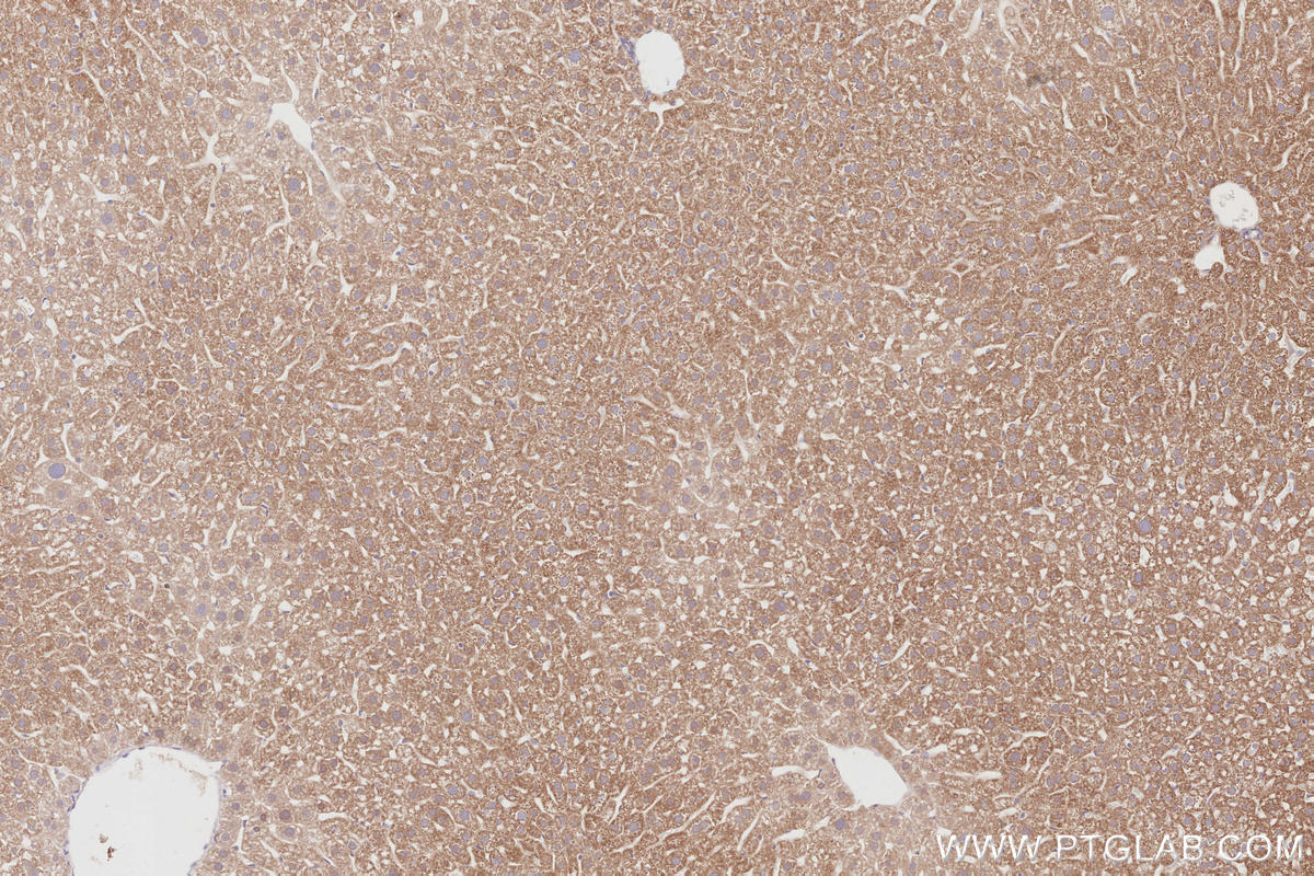 Immunohistochemistry (IHC) staining of mouse liver tissue using CDC42EP4 Polyclonal antibody (19262-1-AP)