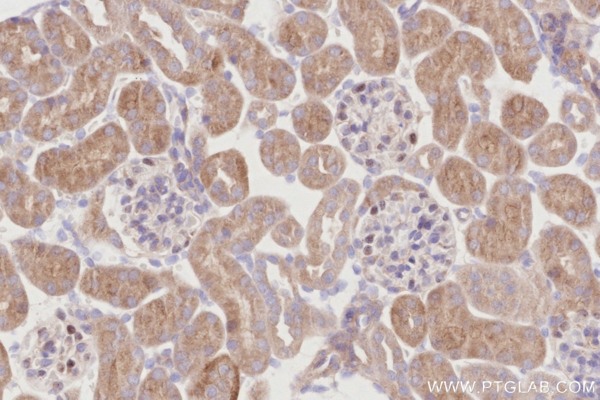 Immunohistochemistry (IHC) staining of mouse kidney tissue using CDC42EP4 Polyclonal antibody (19262-1-AP)