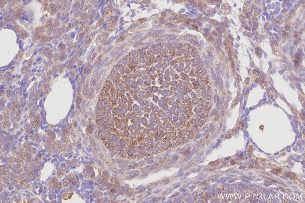 Immunohistochemistry (IHC) staining of mouse ovary tissue using CDC42EP4 Polyclonal antibody (19262-1-AP)