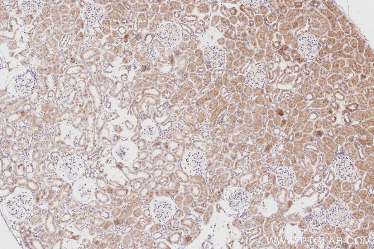 Immunohistochemistry (IHC) staining of rat kidney tissue using CDC42EP4 Polyclonal antibody (19262-1-AP)