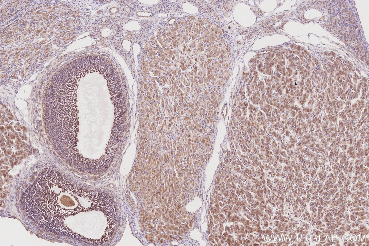 Immunohistochemistry (IHC) staining of rat ovary tissue using CDC42EP4 Polyclonal antibody (19262-1-AP)