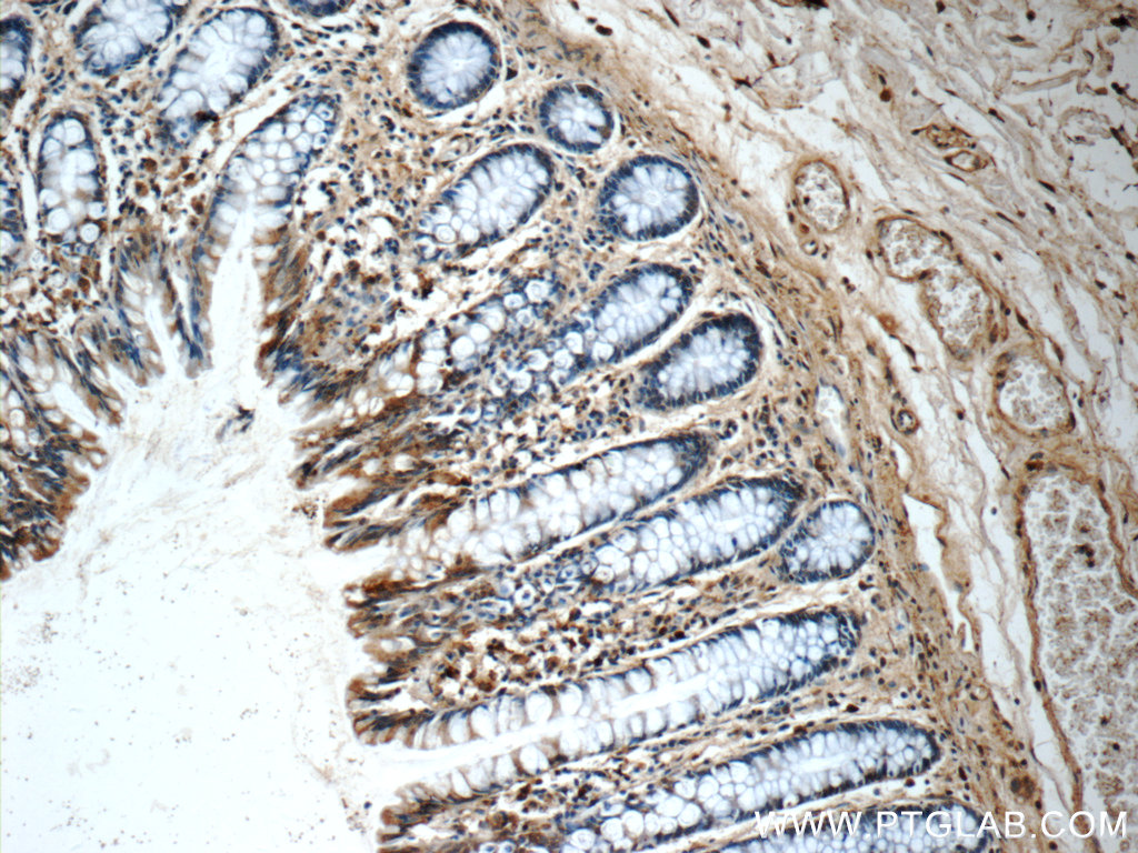 Immunohistochemistry (IHC) staining of human colon tissue using CDC42SE2 Polyclonal antibody (21424-1-AP)