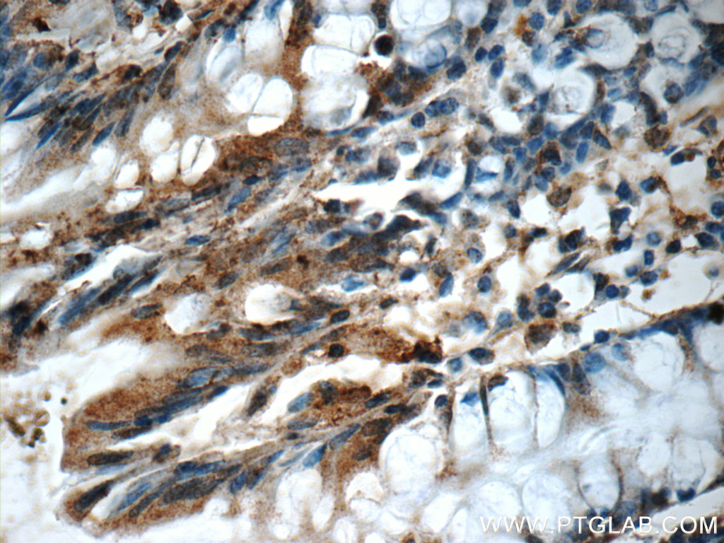 Immunohistochemistry (IHC) staining of human colon tissue using CDC42SE2 Polyclonal antibody (21424-1-AP)