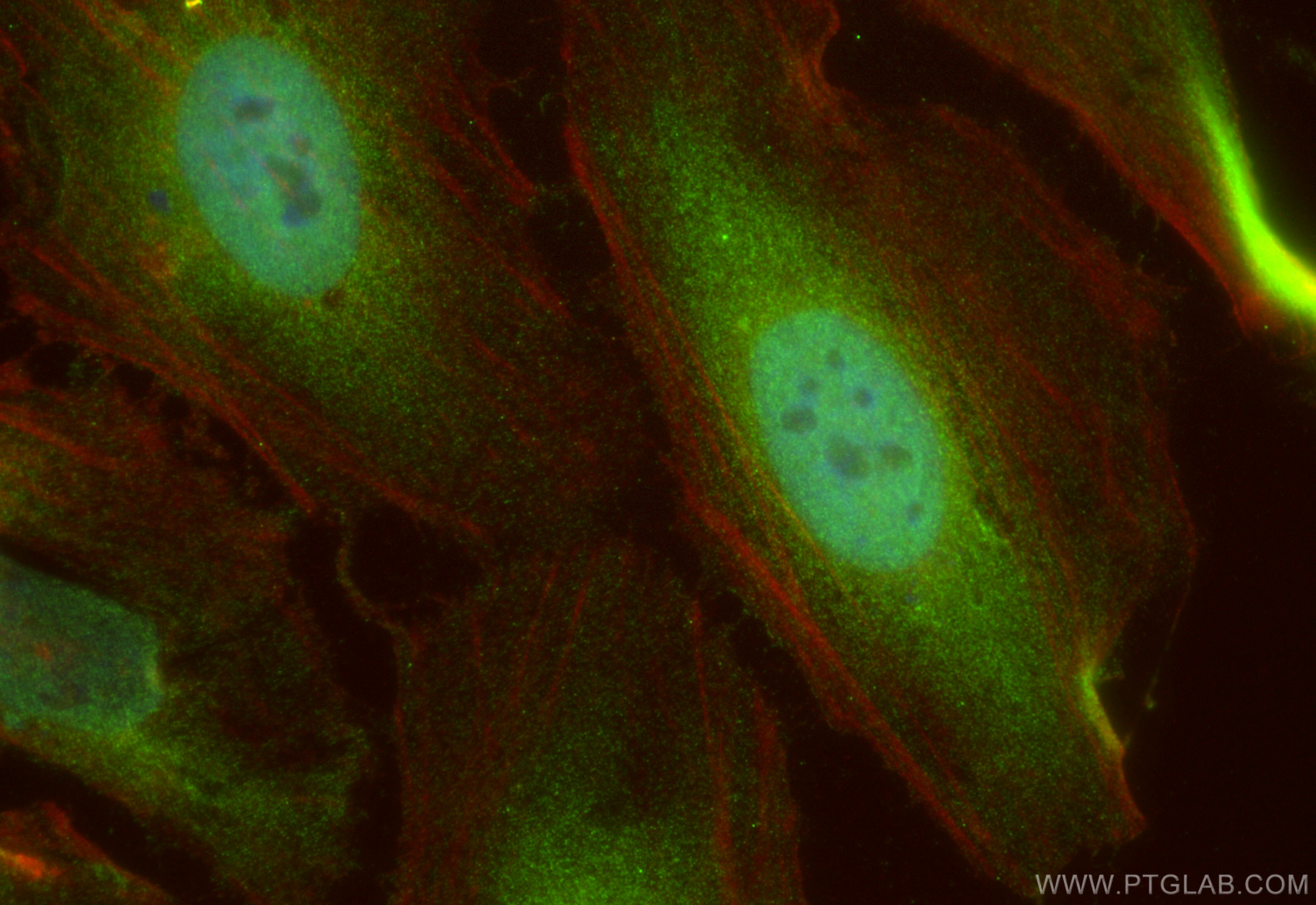 Immunofluorescence (IF) / fluorescent staining of HeLa cells using CDC45L Polyclonal antibody (15678-1-AP)