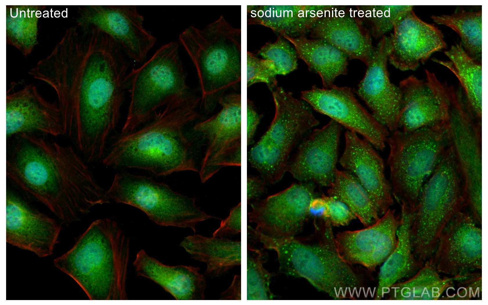 Immunofluorescence (IF) / fluorescent staining of HeLa cells using CDC6 Polyclonal antibody (11640-1-AP)