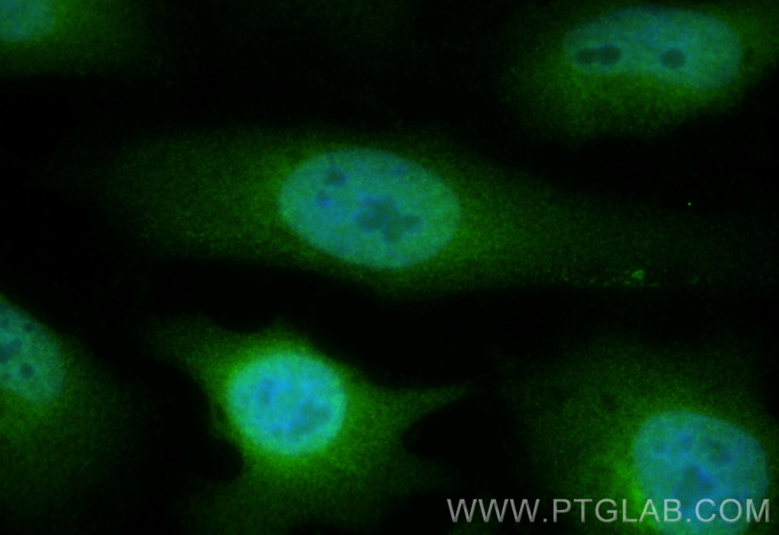 Immunofluorescence (IF) / fluorescent staining of HeLa cells using CDCA5 Polyclonal antibody (29316-1-AP)