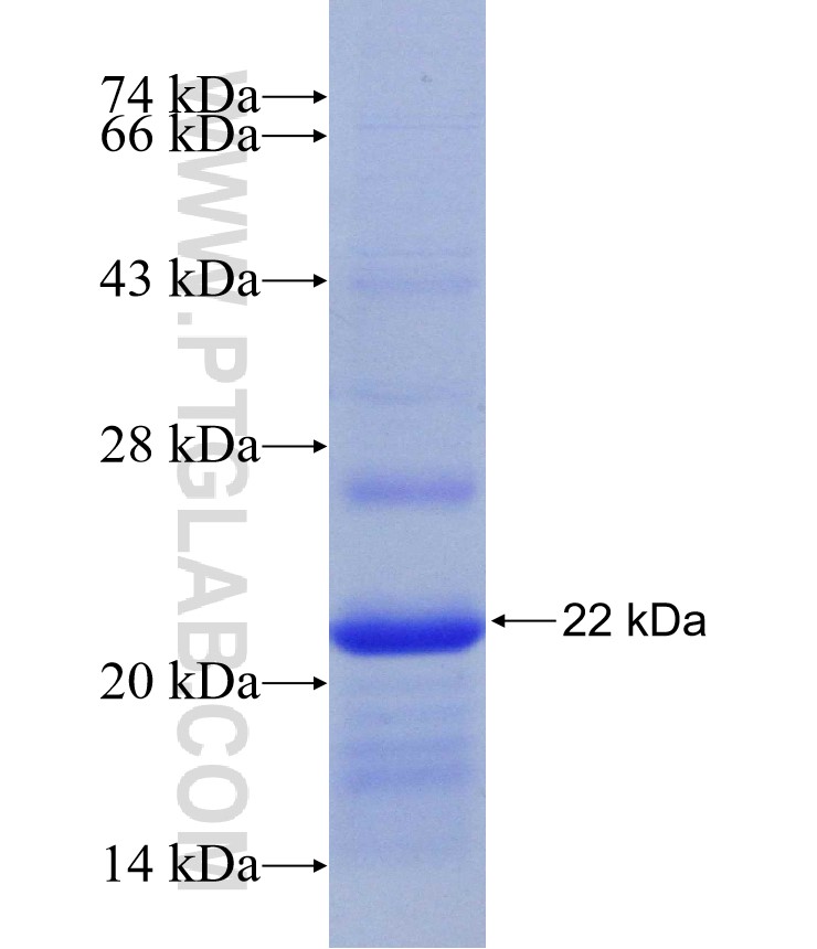 CDCA5 fusion protein Ag30966 SDS-PAGE