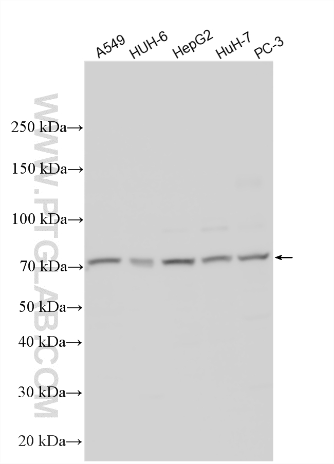 Western Blot (WB) analysis of various lysates using CDCP1 Polyclonal antibody (12754-1-AP)