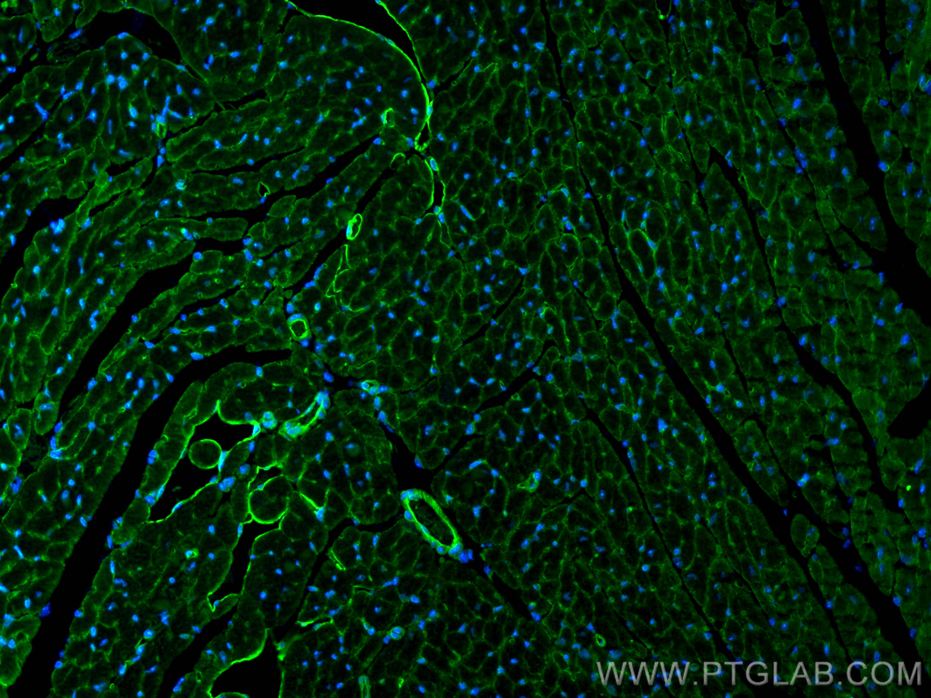 Immunofluorescence (IF) / fluorescent staining of mouse heart tissue using Cadherin-13 Polyclonal antibody (12618-1-AP)