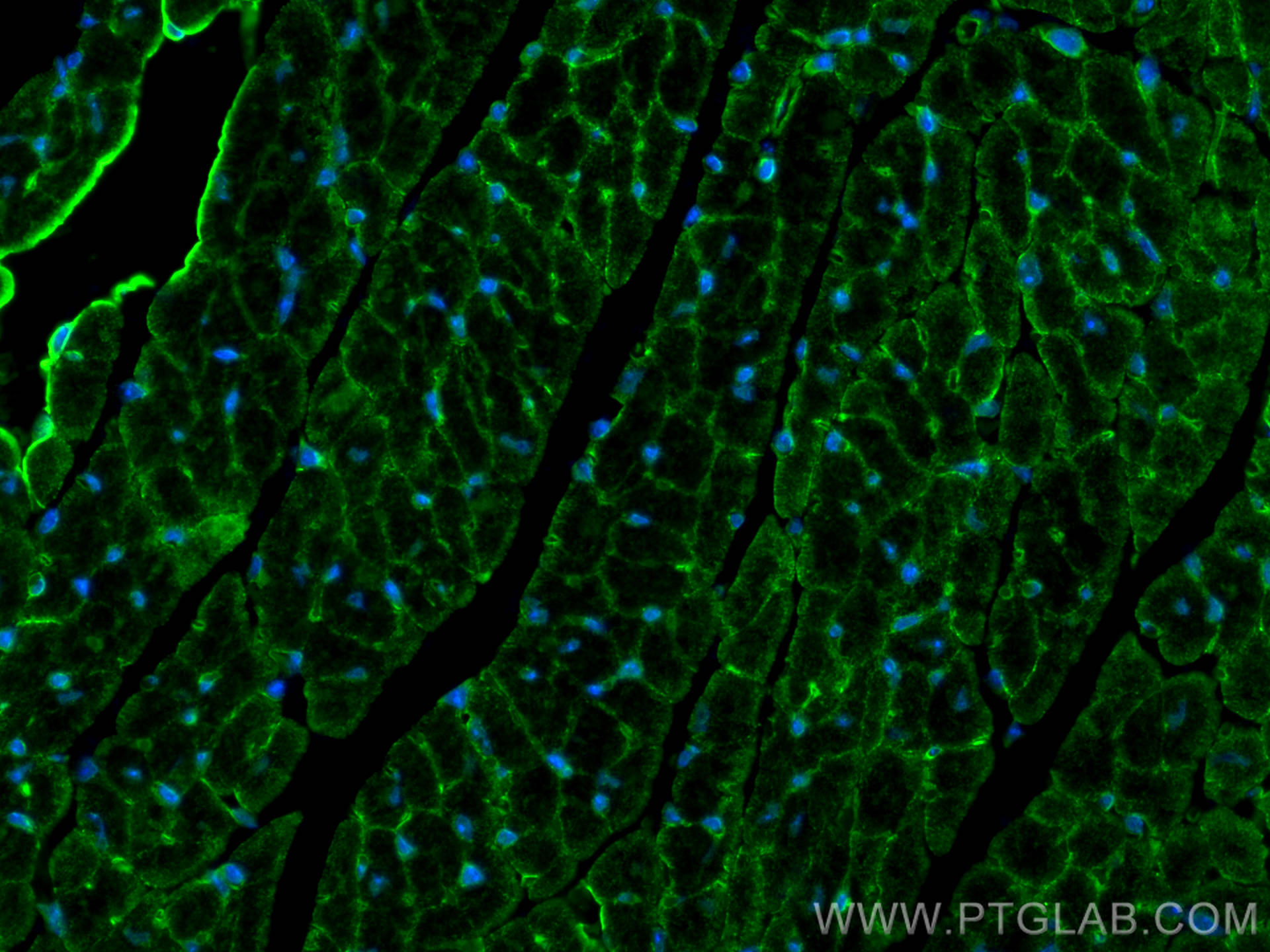 Immunofluorescence (IF) / fluorescent staining of mouse heart tissue using Cadherin-13 Polyclonal antibody (12618-1-AP)