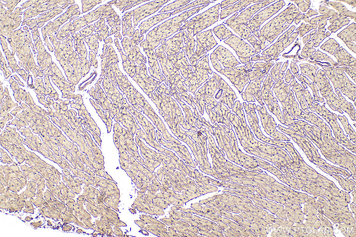 Immunohistochemistry (IHC) staining of mouse heart tissue using Cadherin-13 Polyclonal antibody (12618-1-AP)